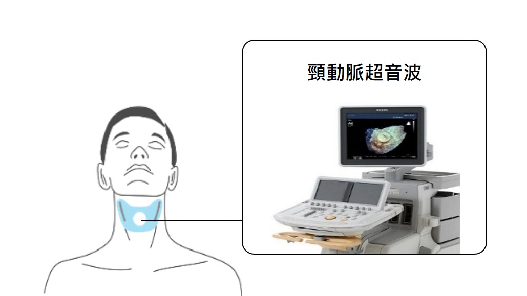 頸動脈阻塞 5G 行動檢測黑科技 配戴實拍